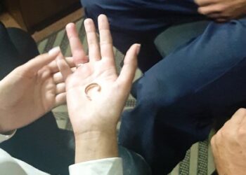 У Львові рятувальники вивільнили палець жінки: він застряг в обручці