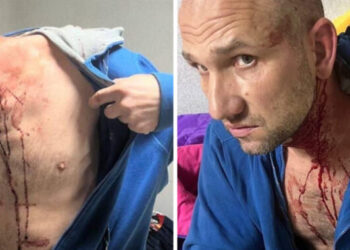 Побитий в Самбірському ТЦК чоловік хотів втекти до Польщі, – ДБР – Надзвичайні події