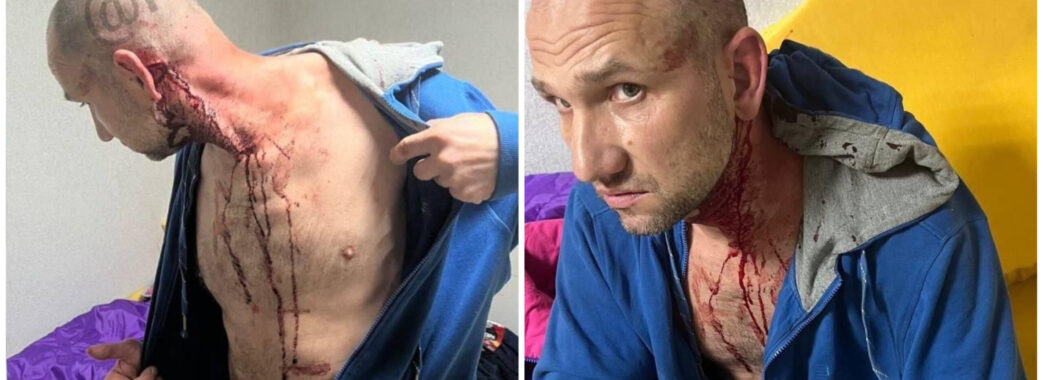 Побитий в Самбірському ТЦК чоловік хотів втекти до Польщі, – ДБР