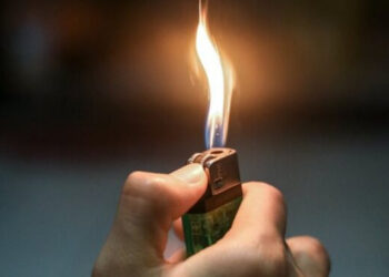 В Днепре 7-летняя девочка подожгла на себе платье и получила серьезные ожоги – Дніпро