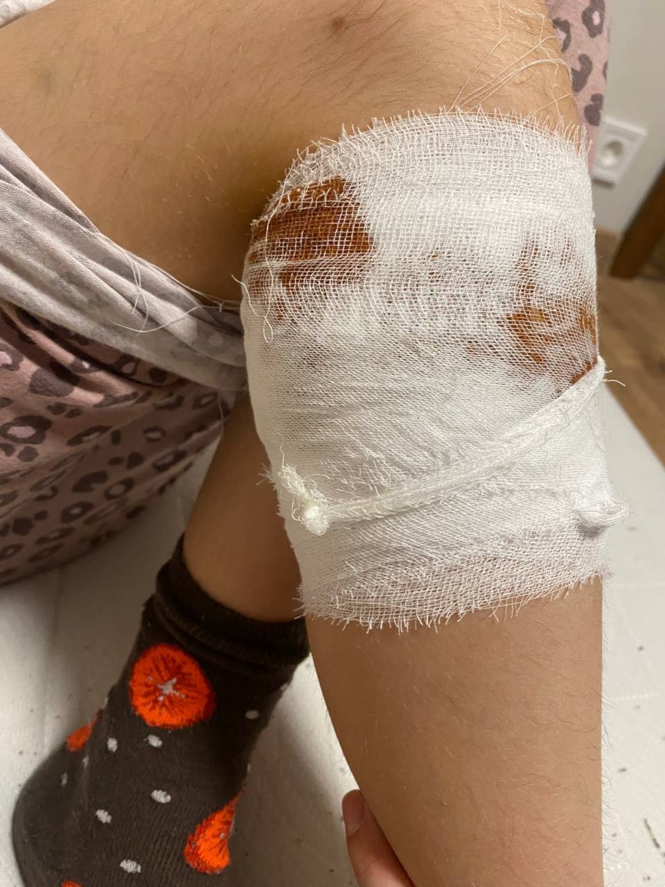 Новости Днепра про В Днепре на Соколе стая собак набросилась на мальчика и искусала его