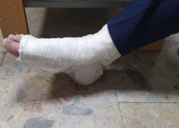 Зламав ногу, коли крав велосипед злодій у Тернополі
