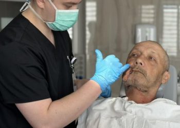 Безпритульний пес відгриз щоку: медики прооперували мешканця Золочева