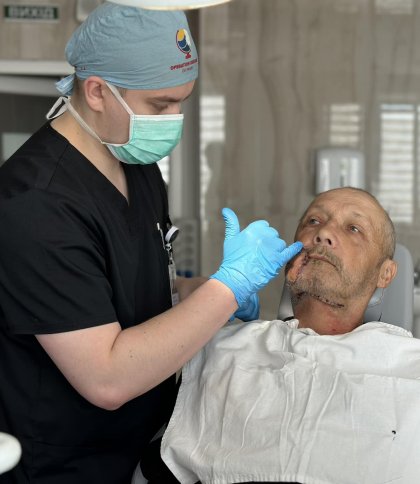 Безпритульний пес відгриз щоку: медики прооперували мешканця Золочева