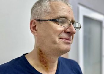 Рідкісна пухлина: львівські хірурги видалили новоутвір на шиї пацієнта