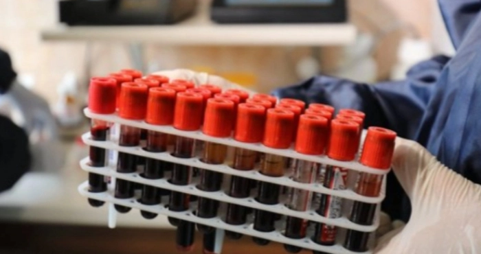 Фото ілюстративне