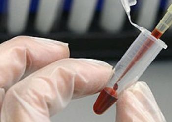 У Львові будуть забезпечувати ліками хворих на множинну мієлому — LVIV.MEDIA