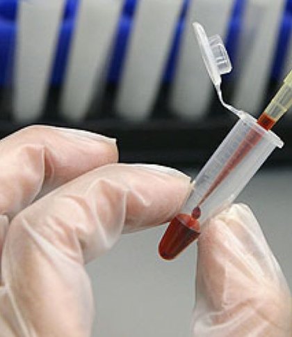 У Львові будуть безоплатно забезпечувати ліками хворих на множинну мієлому