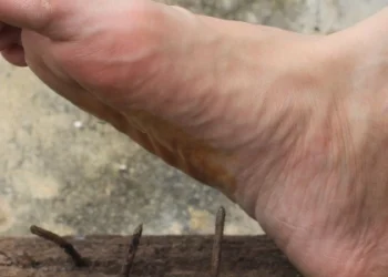 До лікарні у Львові госпіталізували чоловіка з підозрою на правець — Львівщіна