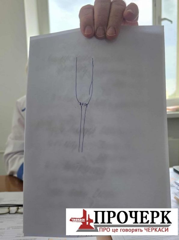 Так виглядає анастомоз — природне або хірургічно створене з’єднання між органами чи структурами організму. У цьому випадку маса тіла дитини — 2 кг 800 г, температура в операційній — 36,6 °C. За час операції лікар втрачає близько трьох кілограмів.