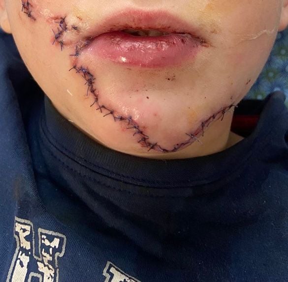 Фото зроблене на наступний день після операції